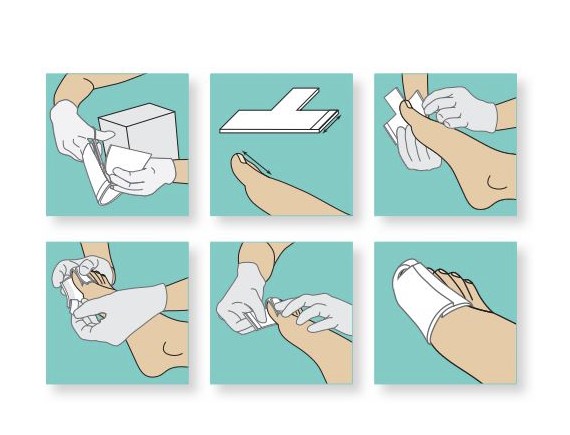 Ligasano weiß steril 14 x 10 x 0,5cm 1St. T-Finger-Bandage