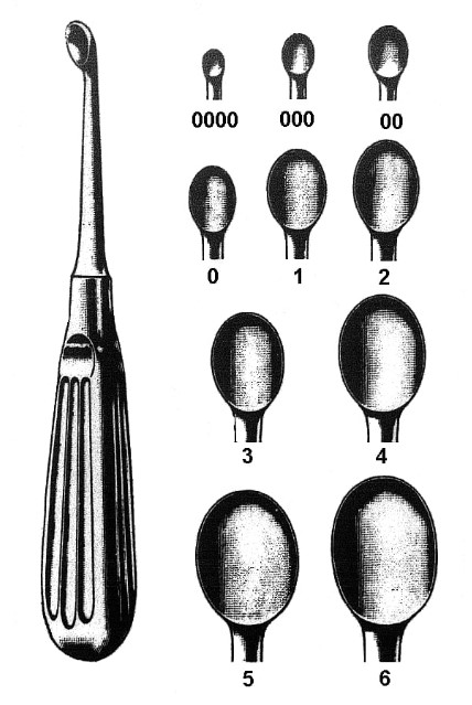 Knochenlöffel Typ Volkmann 0000 2mm